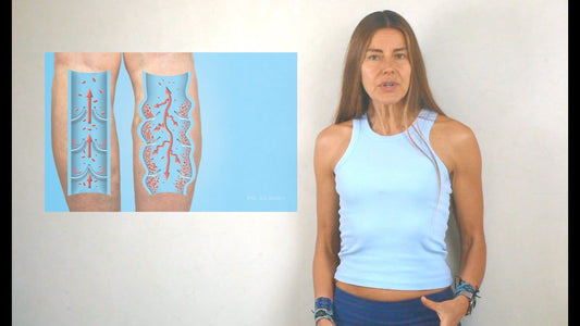 Estrategias sencillas para tratar y prevenir la aparición de venas várices