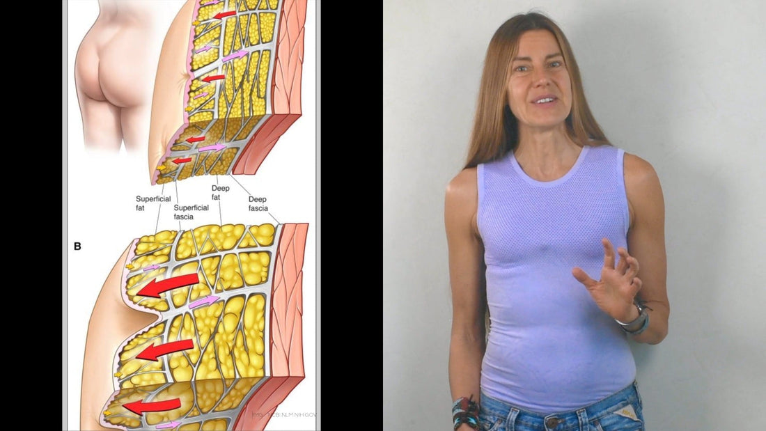 Mitos y verdades sobre la Celulitis