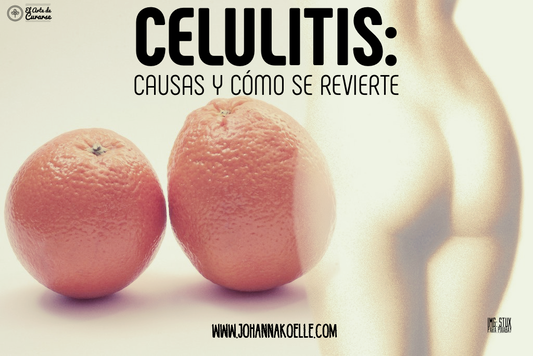 Celulitis: qué la causa y qué se puede hacer para revertirla